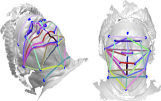 Predicting sleep apnea from three-dimensional face photography